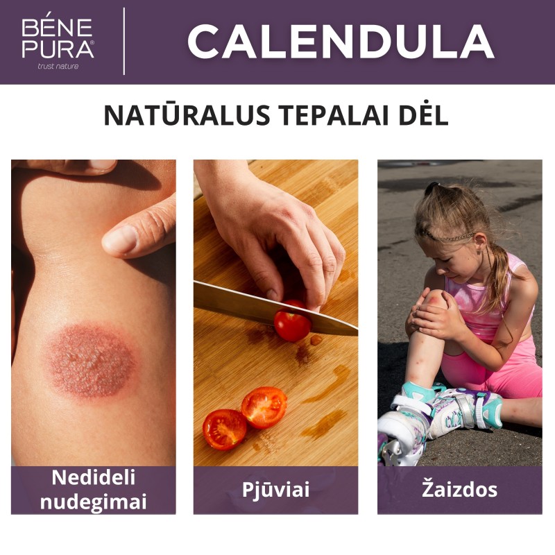 Tepalai nuo žaizdoms, nudegimo ir niežėjimo 2 Rinkinys
