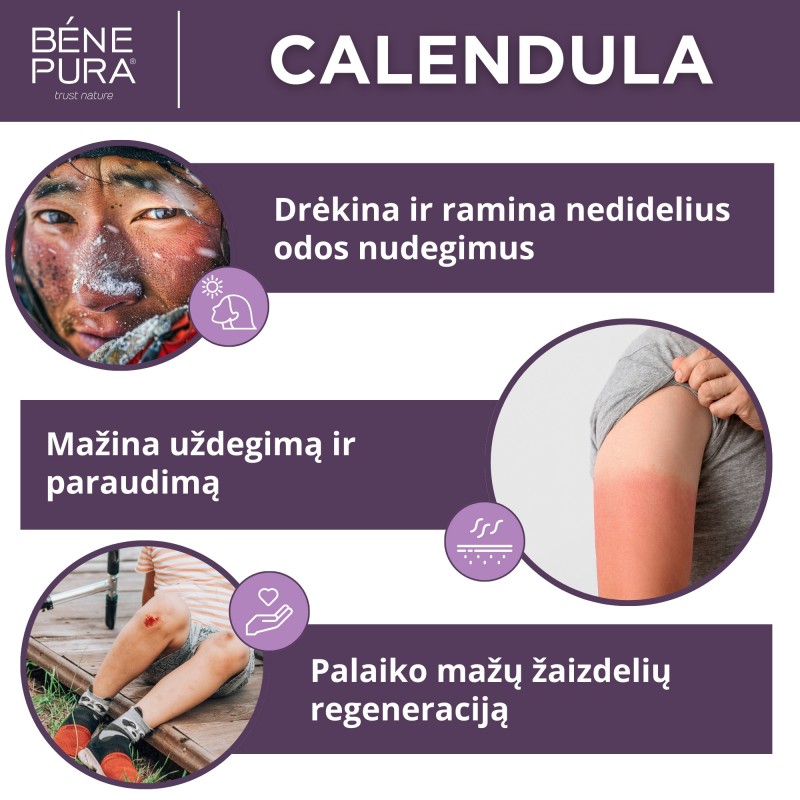 Nudegimų ir žaizdų tepalas su Medetkomis - 40ml