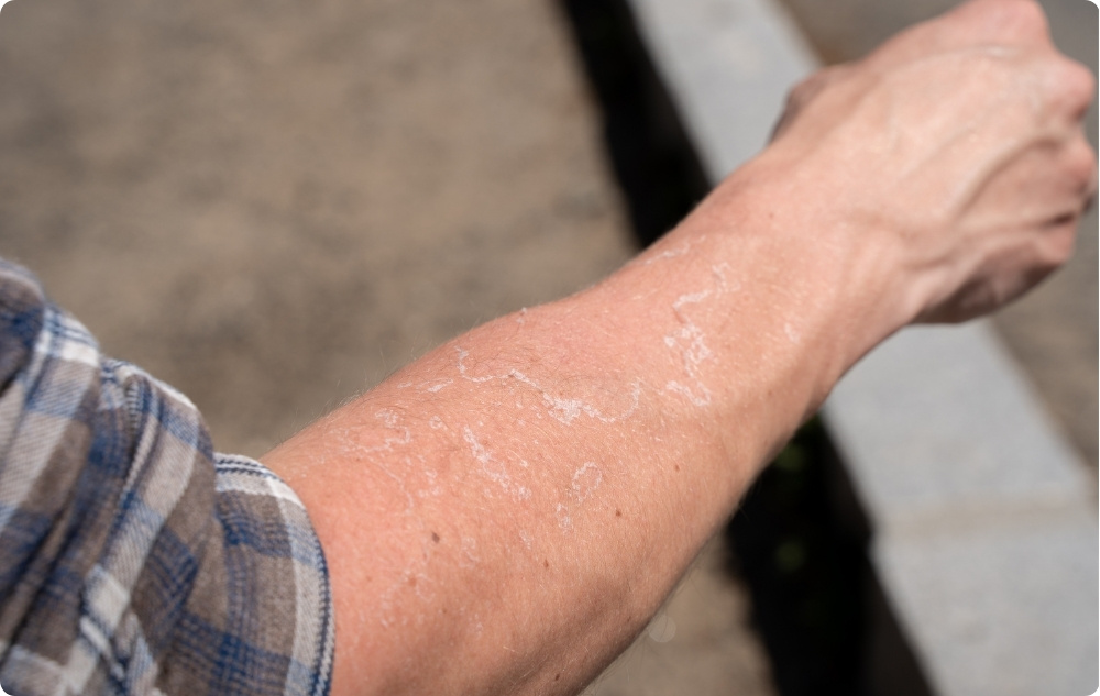 Kaip aliejus sudirgintai ir sausai odai