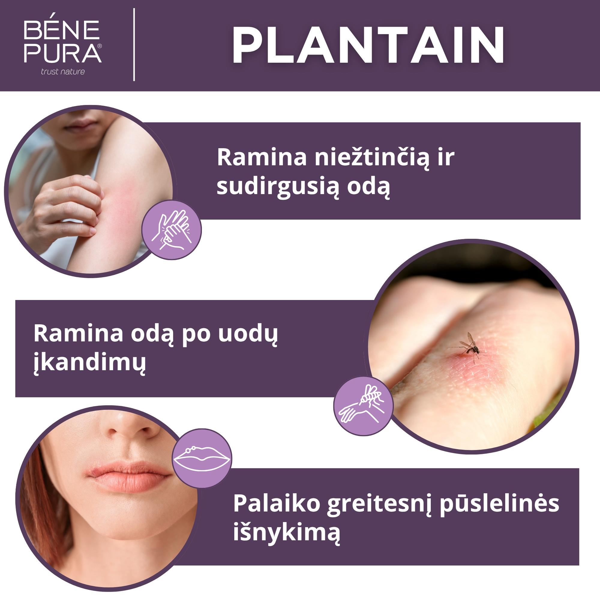 "Tepalai nuo žaizdoms, nudegimo ir niežėjimo 2" Rinkinys