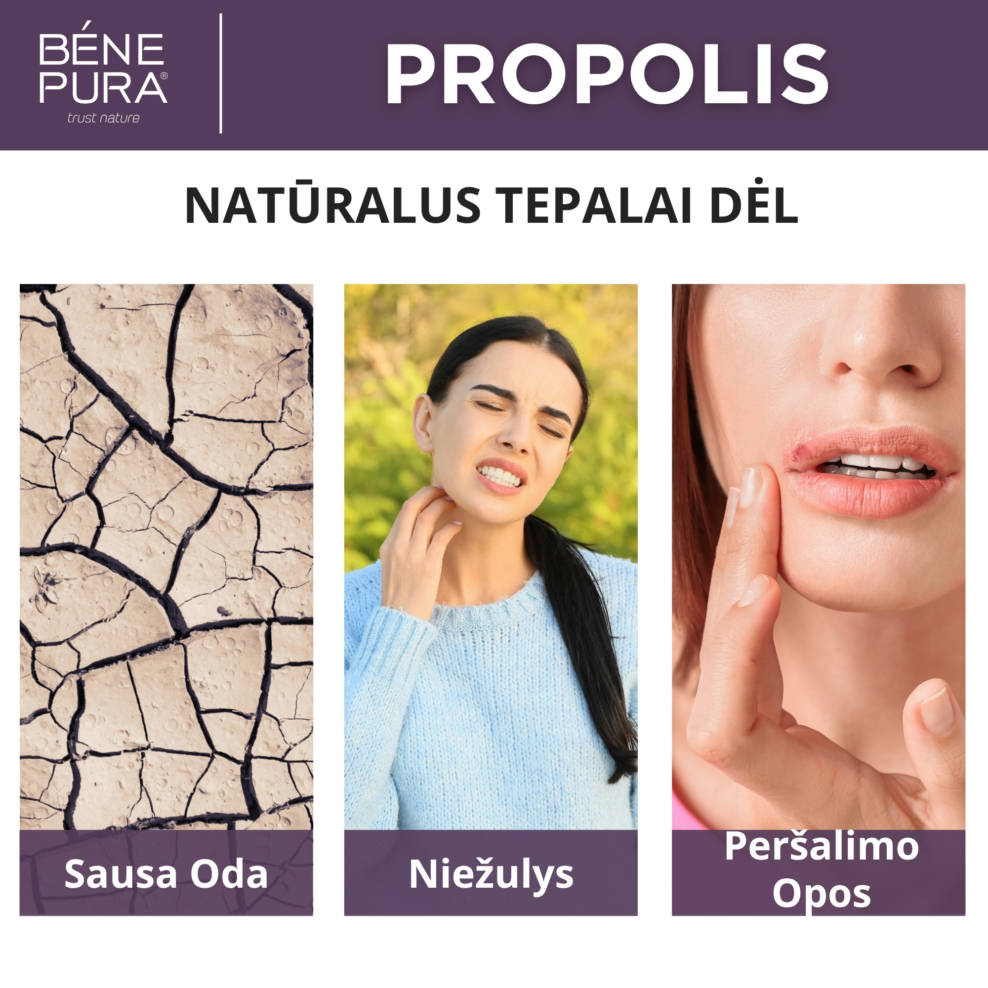"Tepalai nuo žaizdoms, nudegimo ir niežėjimo 2" Rinkinys