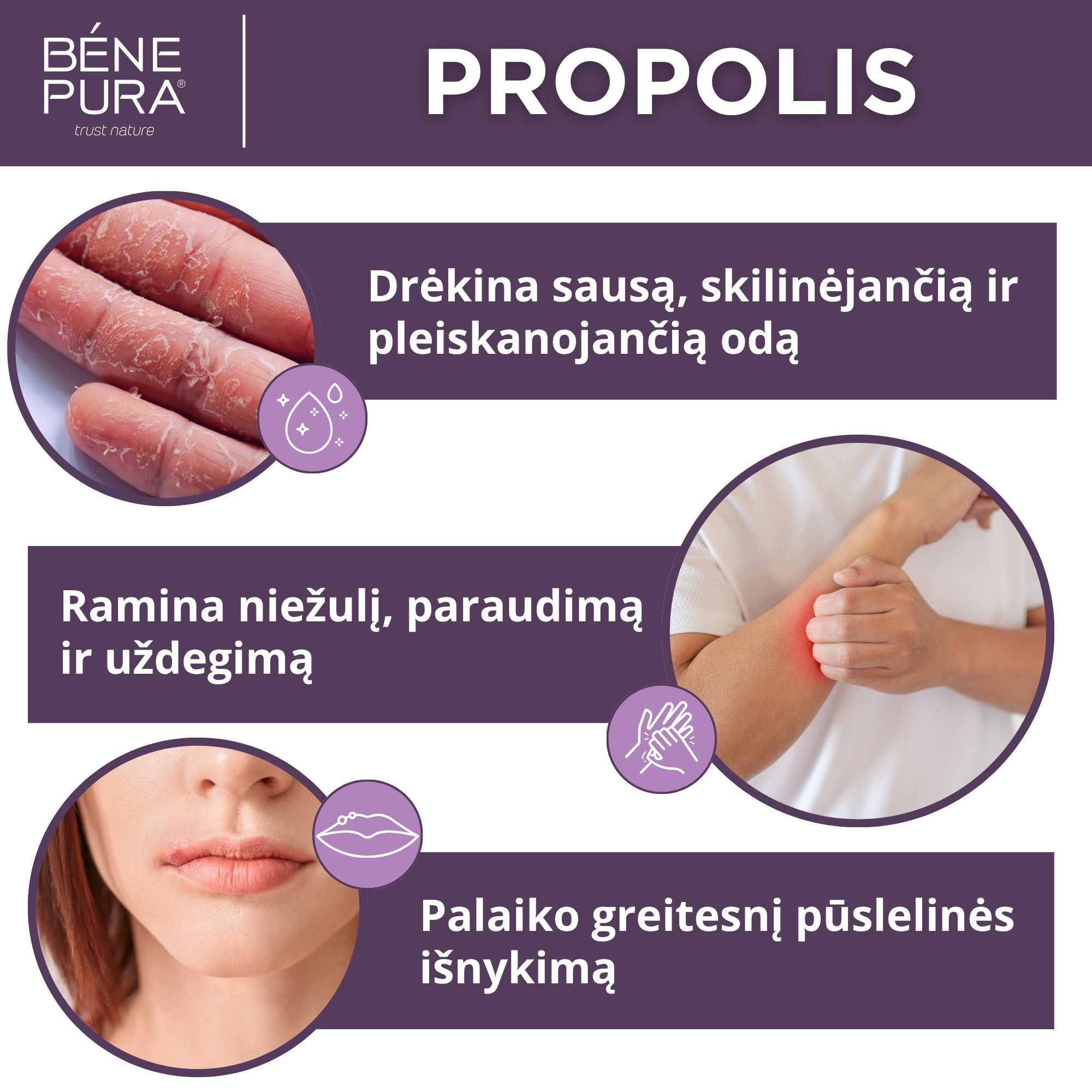 "Tepalai nuo žaizdoms, nudegimo ir niežėjimo 2" Rinkinys