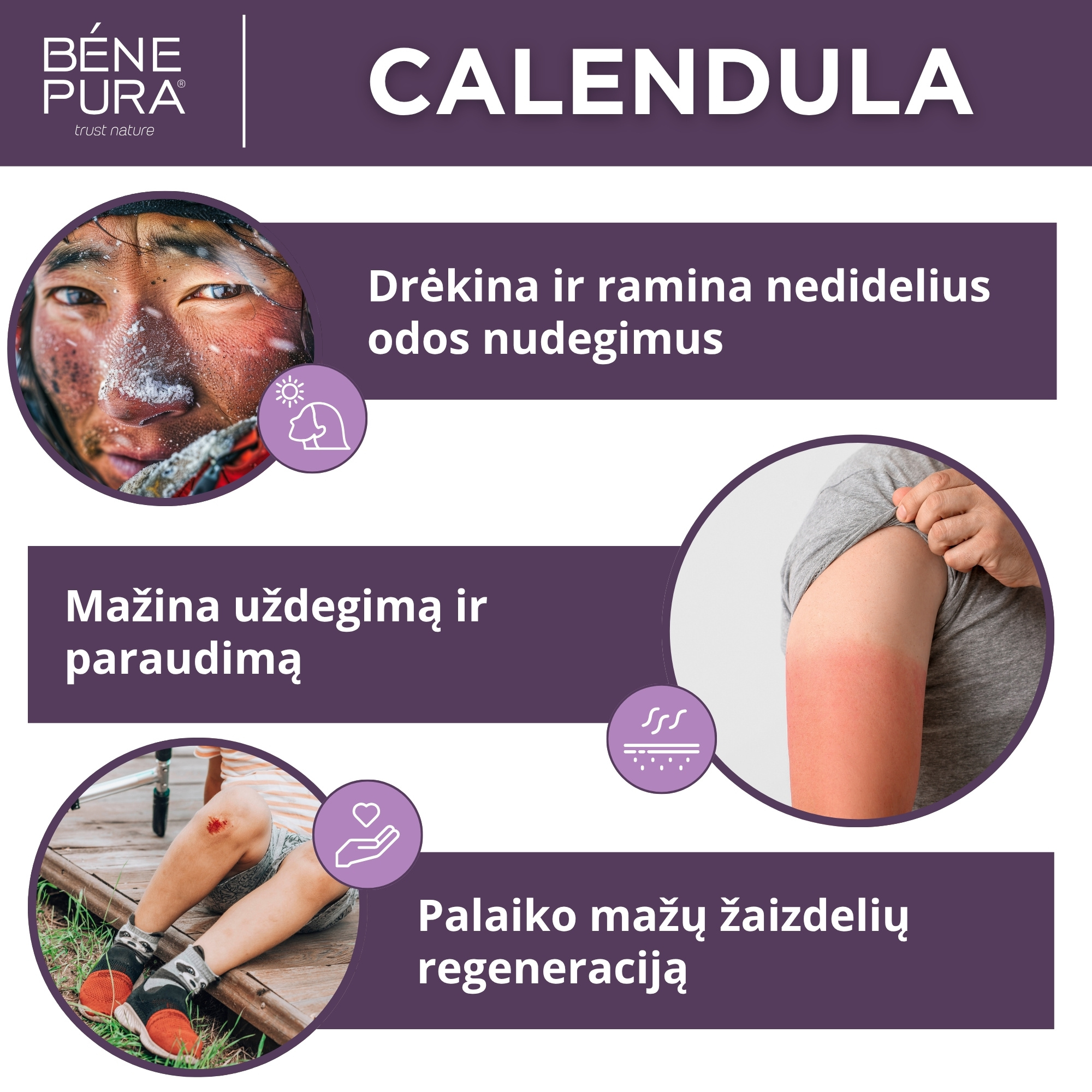 "Tepalai nuo žaizdoms, nudegimo ir niežėjimo 2" Rinkinys